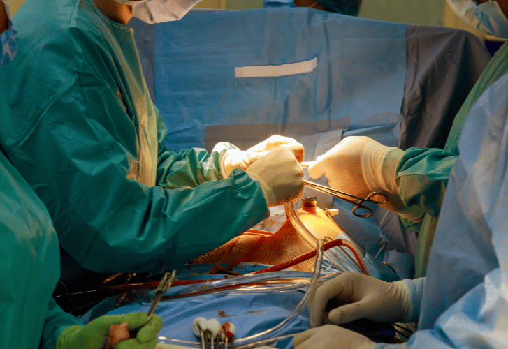 open heart surgery